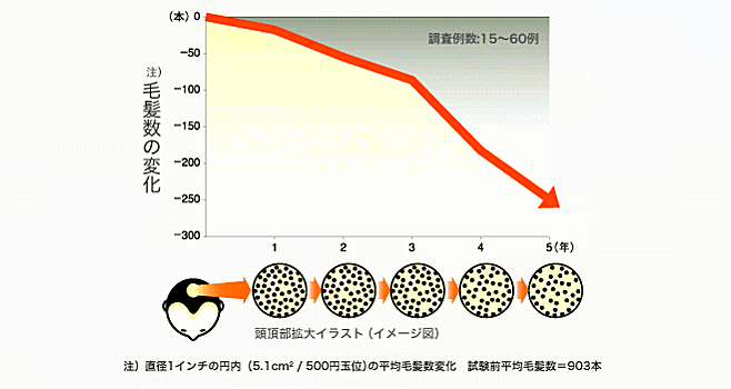 毛髪数の変化