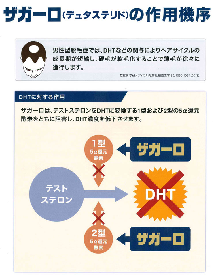 最新薬　デュタステリド